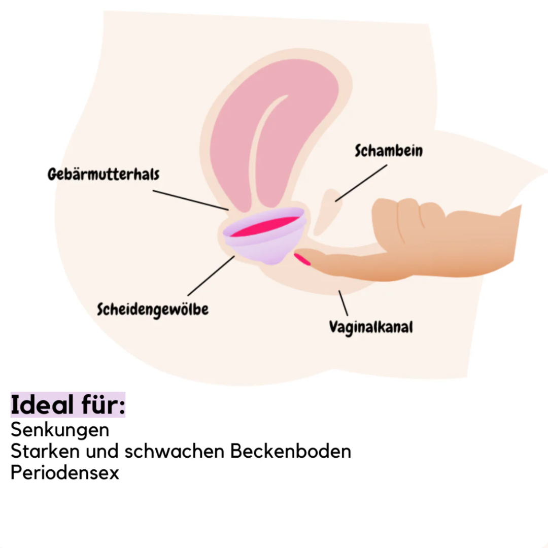 Femmora Einwegscheiben 10-Pack