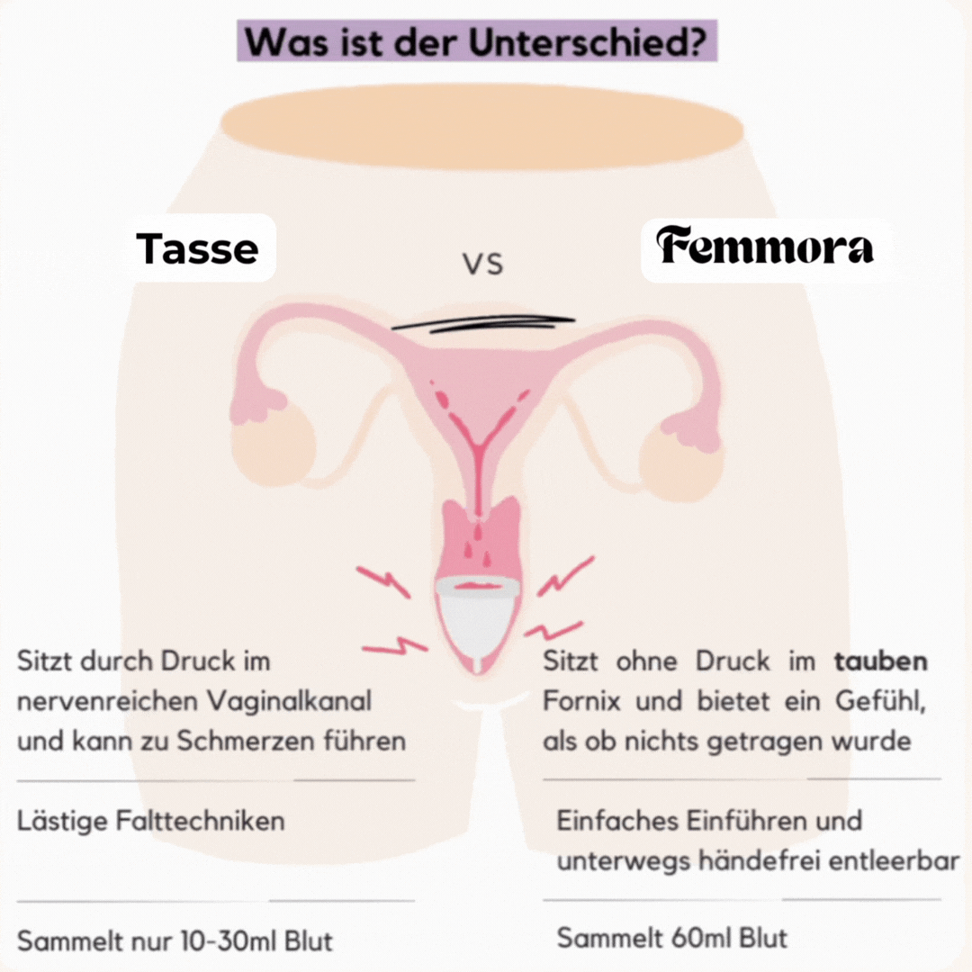 Femmora Einwegscheiben 10-Pack